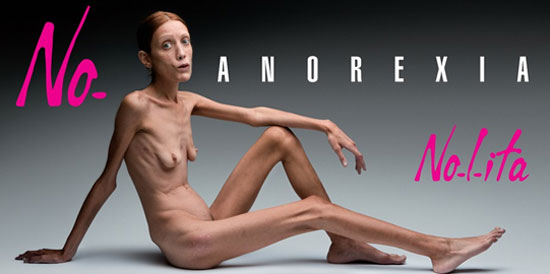 bulimarexia, bulimia, anorexia, eating disorders, mental health, health