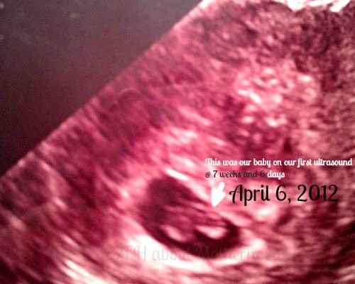 National Pregnancy and Infant Loss Awareness, miscarriage, loss